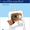 The Art of Pterygium Surgery: Mastering Techniques and Optimizing Results (EPUB and pdf)