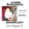 2022 Closed Atraumatic Rhinoplasty and FaceLift&NeckLift Course 7