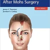 Facial Reconstruction After Mohs Surgery (videos and pdf )