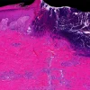 Mayo Clinic Wound Symposium: The Edges Of Wound Care 2023 (Videos+Assessment Quiz)