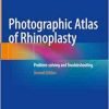 Photographic Atlas of Rhinoplasty: Problem-solving and Troubleshooting, 2nd Edition pdf and videos