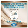 Quality Medical Publishing Advanced Open Rhinoplasty Techniques in Primary and Secondary Cases 2016
