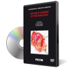 Aesthetic Surgery of the Aging Face (6 DVD BOX)