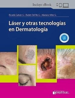 Láser y otras tecnologías en Dermatología (Original PDF from Publisher)