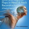 Local And Regional Flaps In Head And Neck Reconstruction A Practical Approach VideosPPT