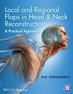 Local And Regional Flaps In Head And Neck Reconstruction A Practical Approach VideosPPT