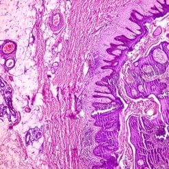 Oakstone Dermatopathology 2025